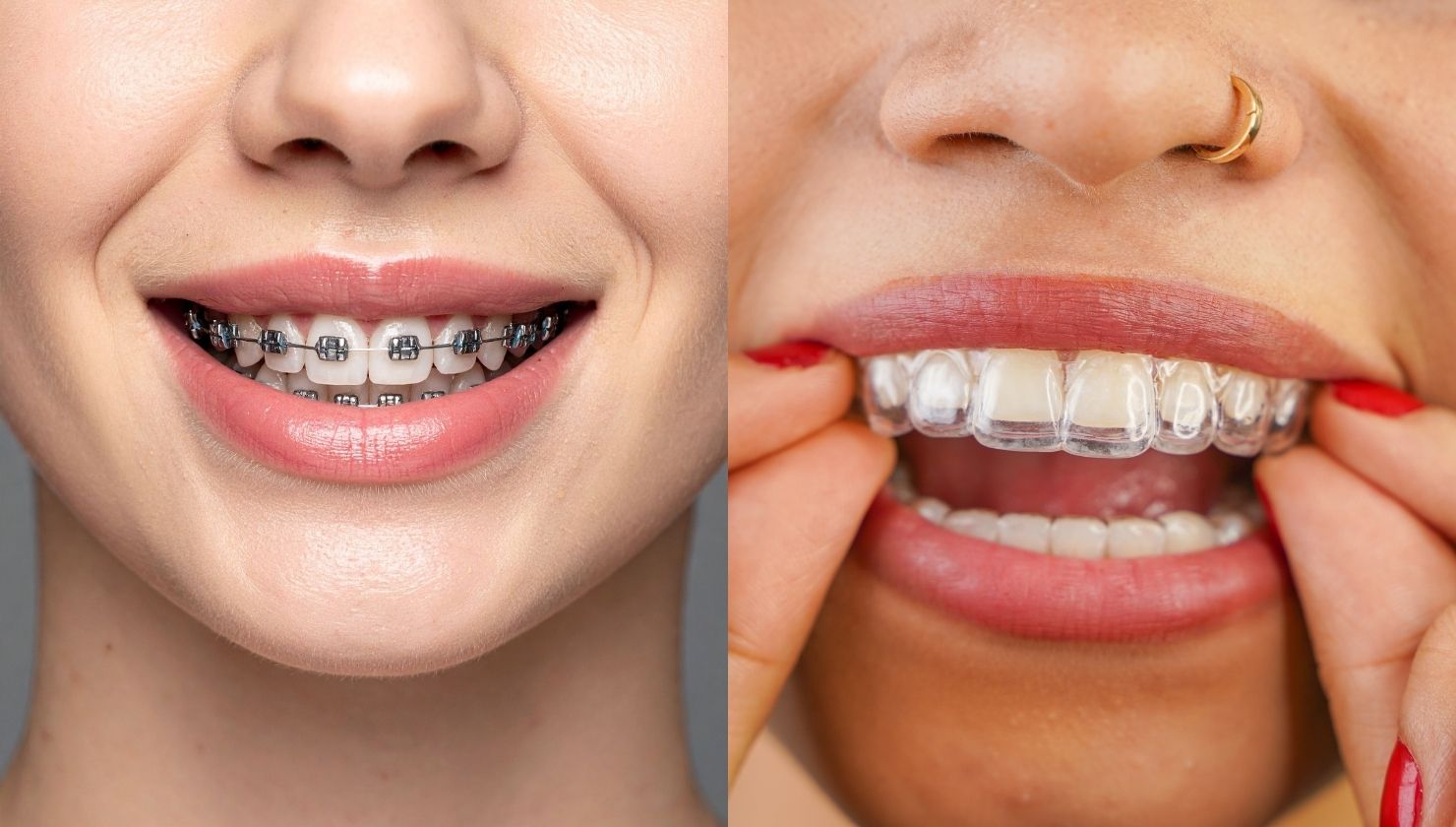 dr-saba-best-orthodontist-in-abu-dhabi-blog