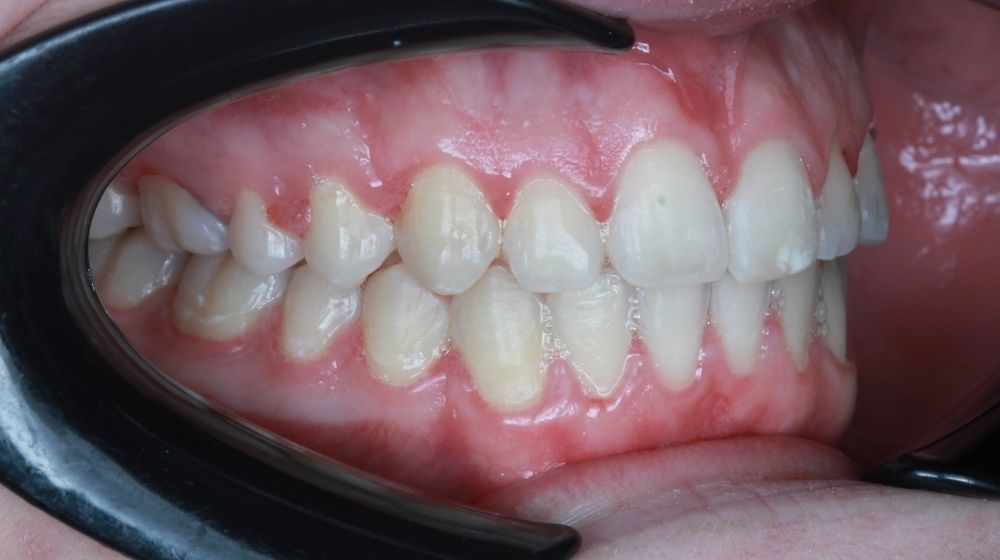 dr saba orthodontist in abu dhabi