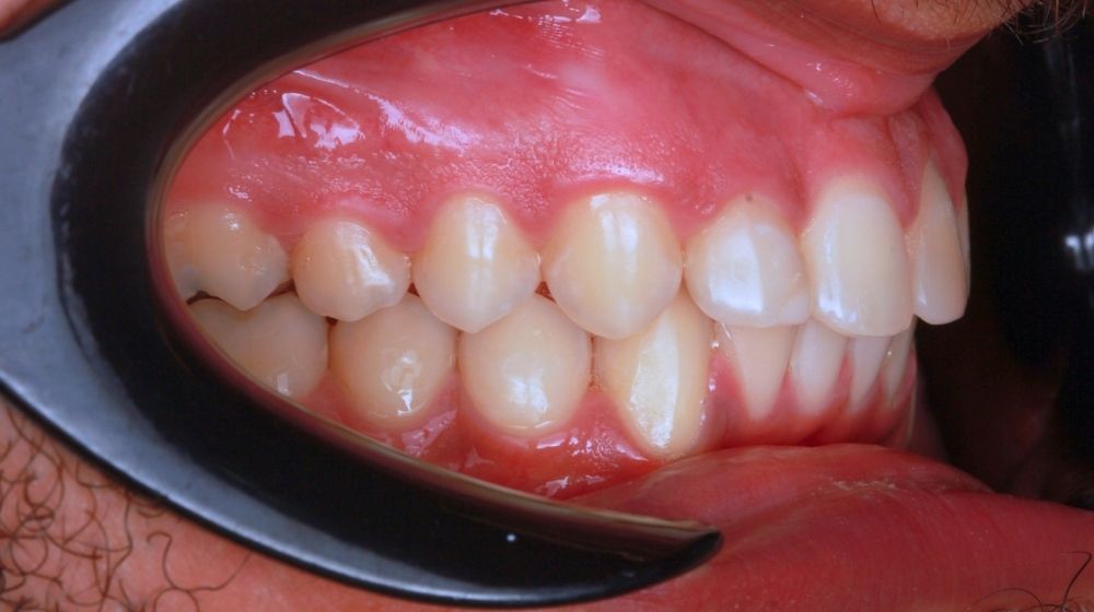 dr saba orthodontist in abu dhabi