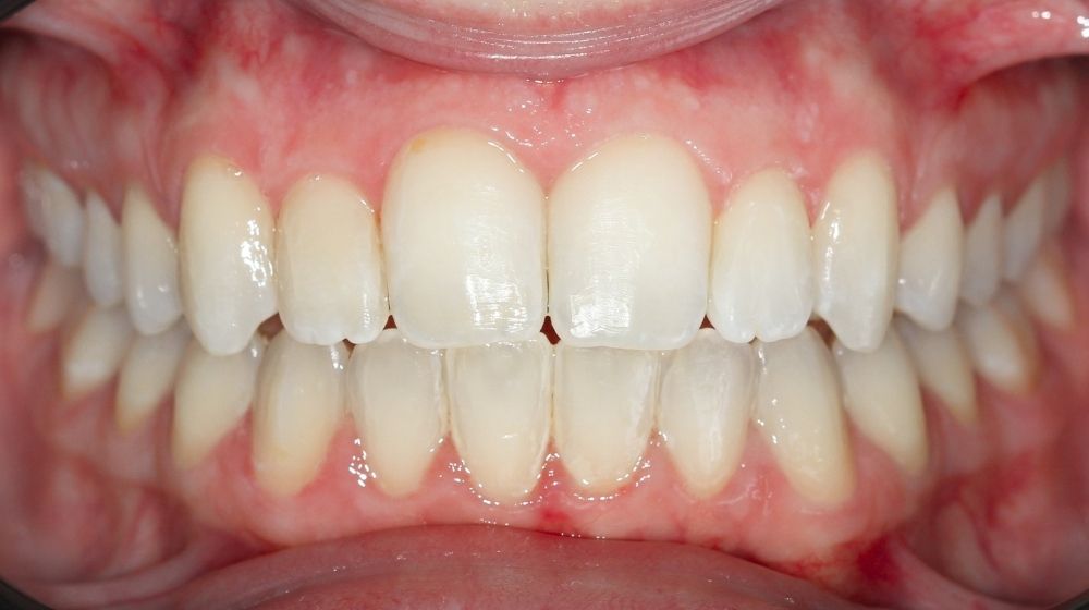 dr saba orthodontist in abu dhabi