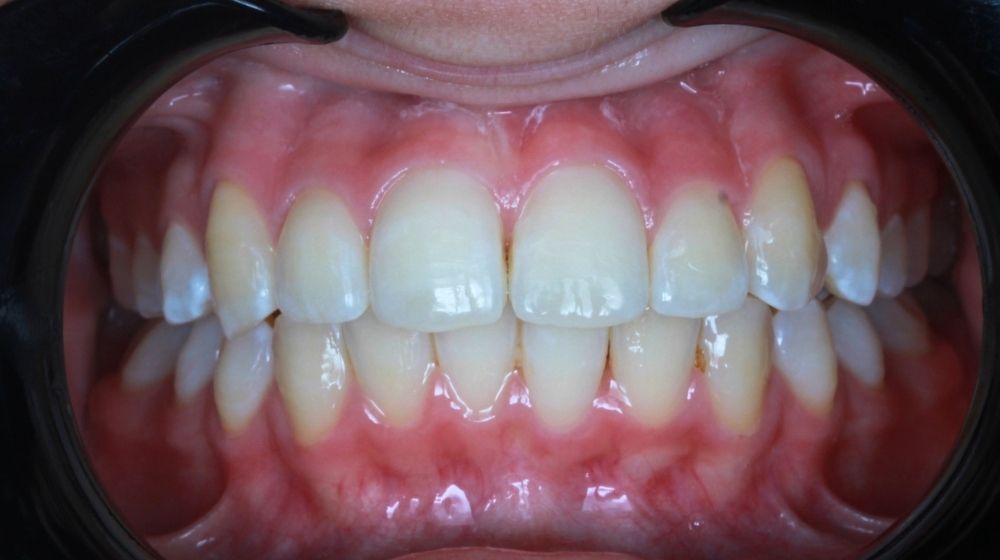 dr saba orthodontist in abu dhabi