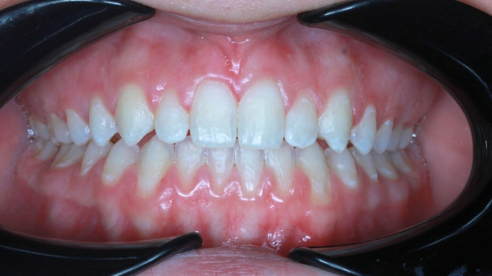 dr saba orthodontist in abu dhabi