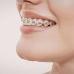 dr saba orthodontist in abu dhabi