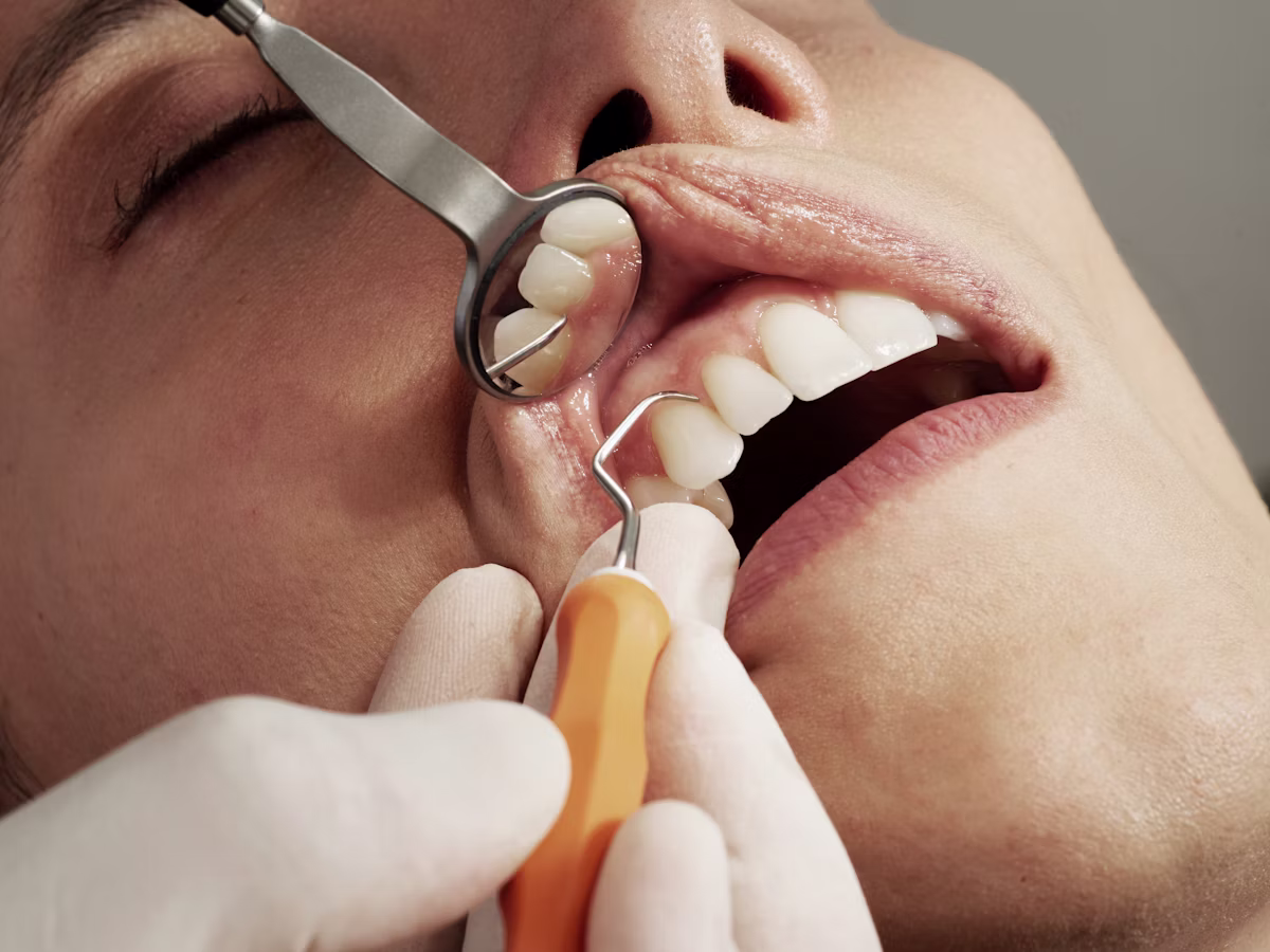 Close-up of clear aligners and fixed braces used to correct bite alignment