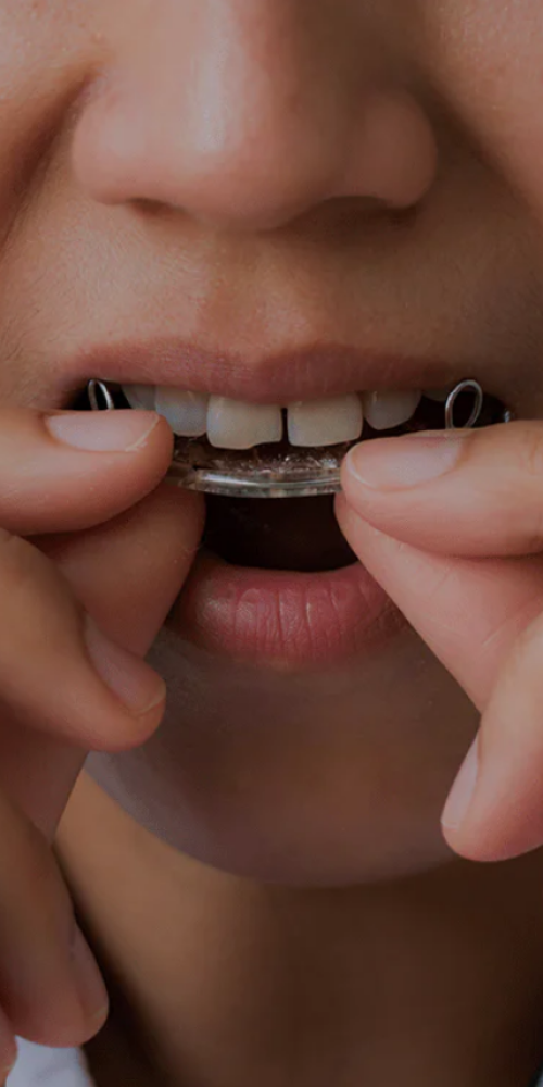 Dr Sabaortho retainers