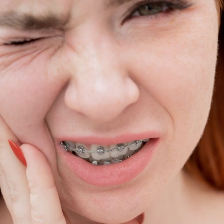 dr-saba-best-orthodontist-in-abu-dhabi-blog