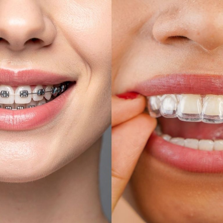 dr-saba-best-orthodontist-in-abu-dhabi-blog